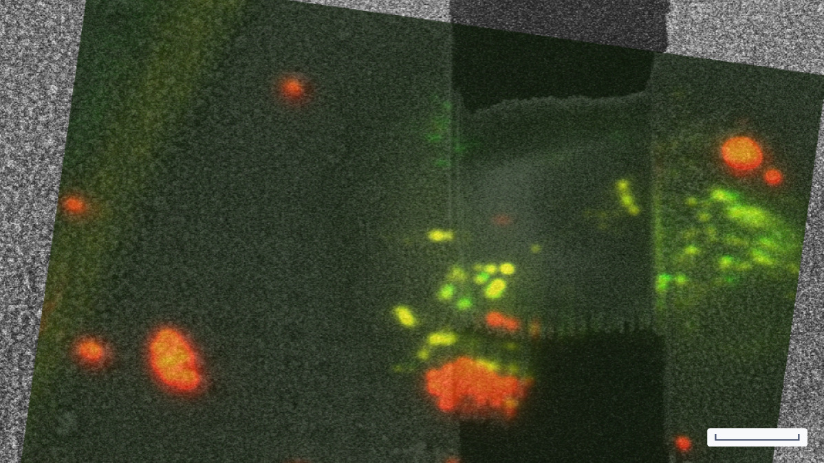 C_Media-slider_RPE-1-Cells_scalebar_10um