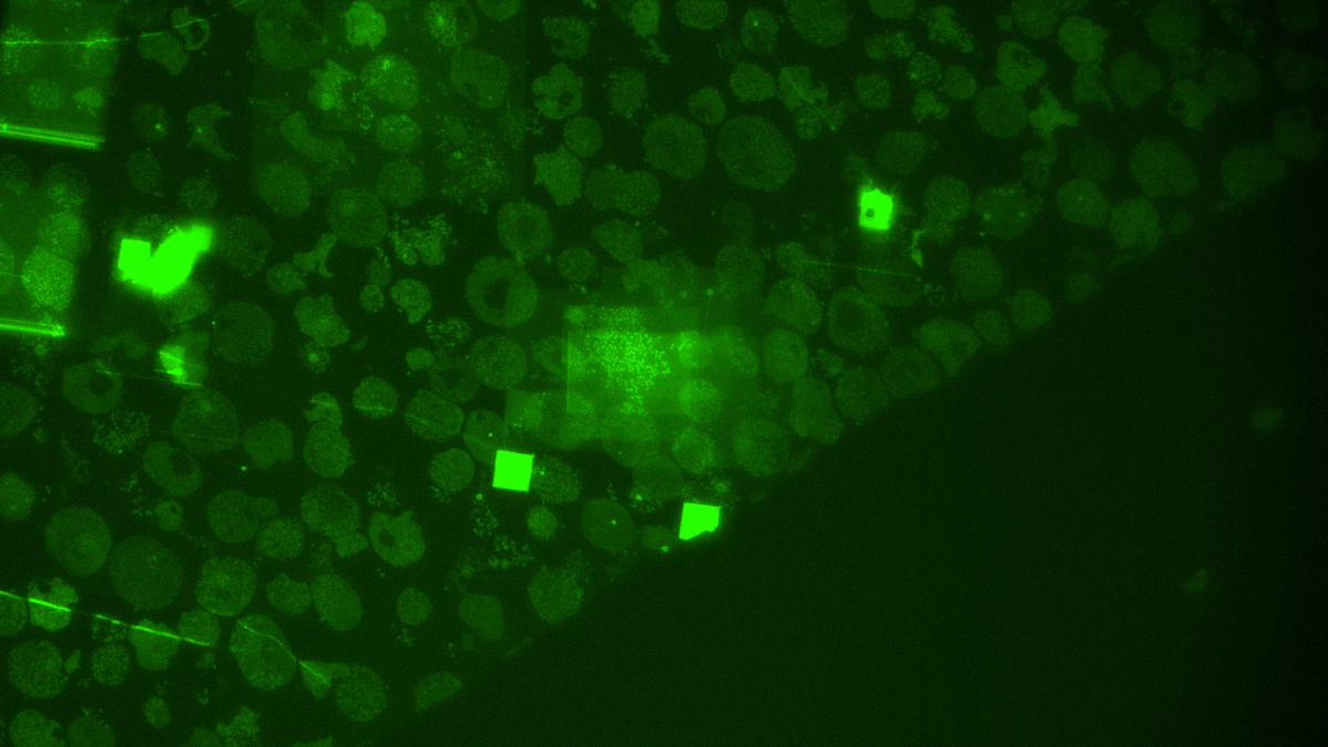 Tupan-virus-cells