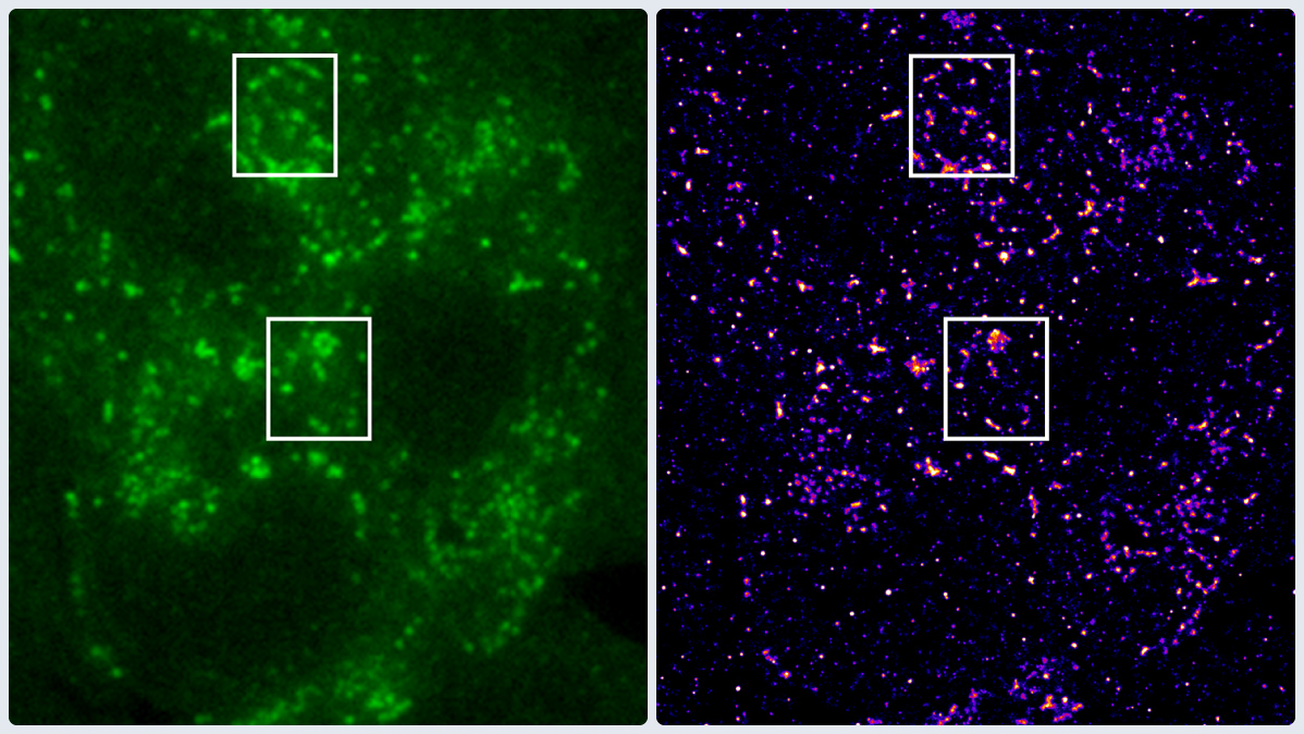YFP-A3-in-HeLa-cells