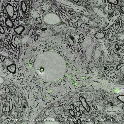 What is Correlative Light and Electron Microscopy?