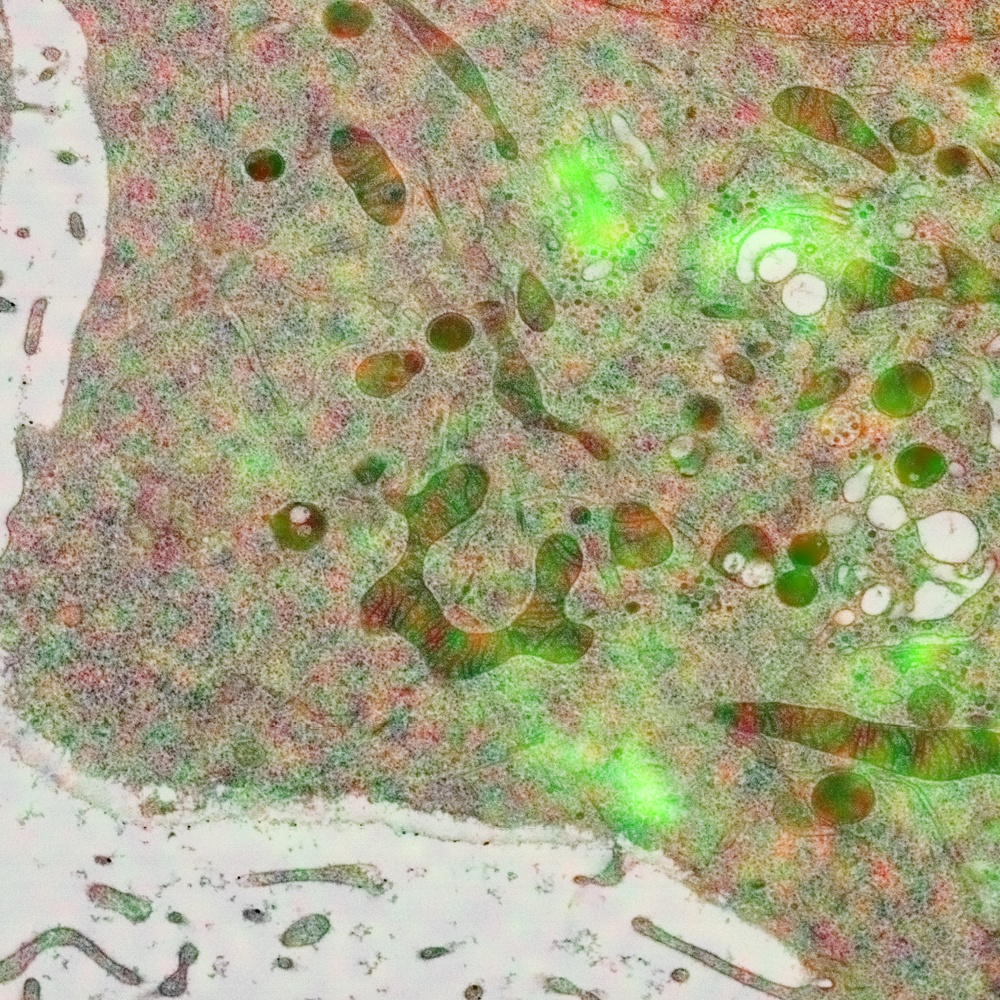 Plant Cell Under Light Microscope Labelled - Micropedia