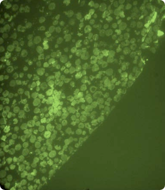 placeholder-feature-slider