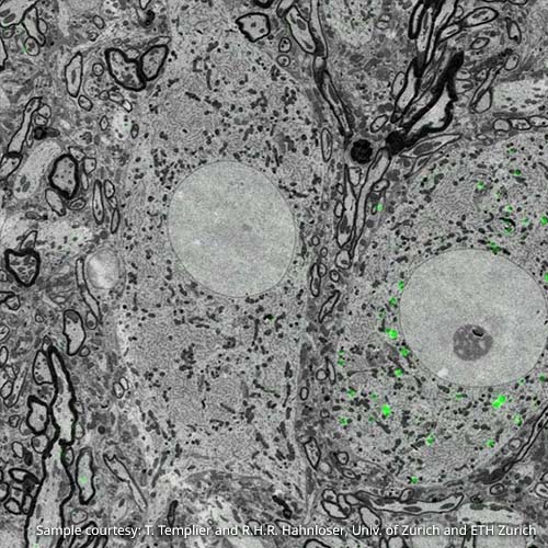 https://request.delmic.com/hubfs/Website/Figures/correlative-microscopy-neuroscience-overlay.jpg