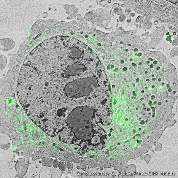 https://request.delmic.com/hubfs/social-suggested-images/hela-cancer-cell-correlative-light-electron-microscope.jpg